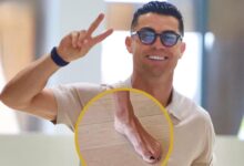ظهور متكرر يثير الجدل، لماذا يطلي كريستيانو رونالدو أظافر قدميه بالأسود؟