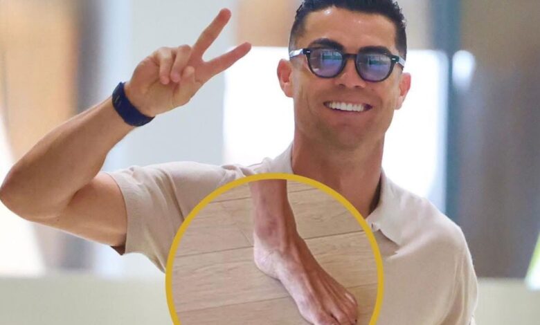 ظهور متكرر يثير الجدل، لماذا يطلي كريستيانو رونالدو أظافر قدميه بالأسود؟